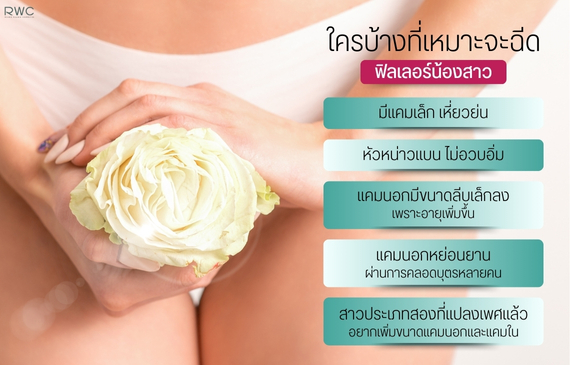 ใครบ้างที่เหมาะจะฉีดฟิลเลอร์น้องสาว ฟิลเลอร์น้องสาว