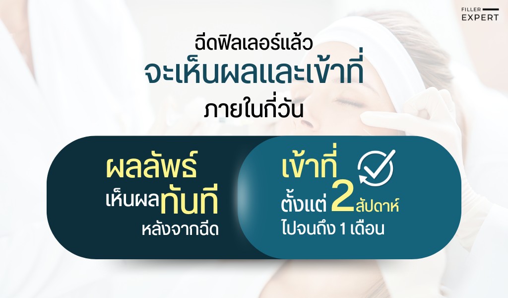 ฉีดฟิลเลอร์กี่วันเข้าที่ และกี่วันเห็นผล