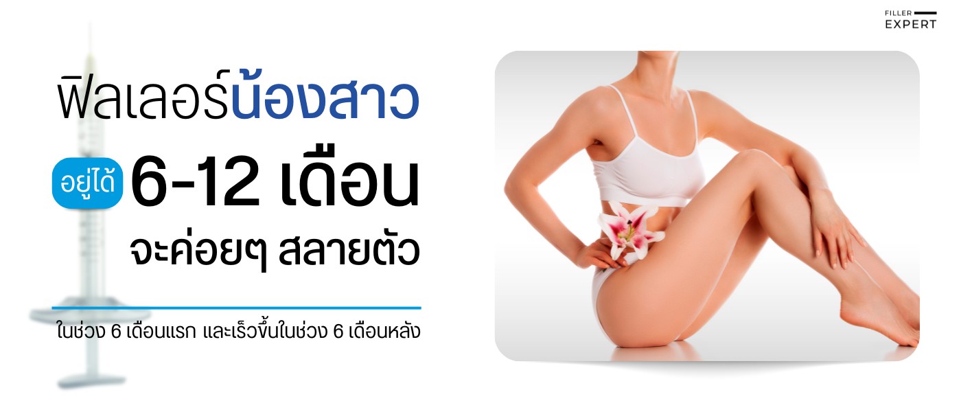 ระยะเวลาที่ฟิลเลอร์น้องสาวคงอยู่