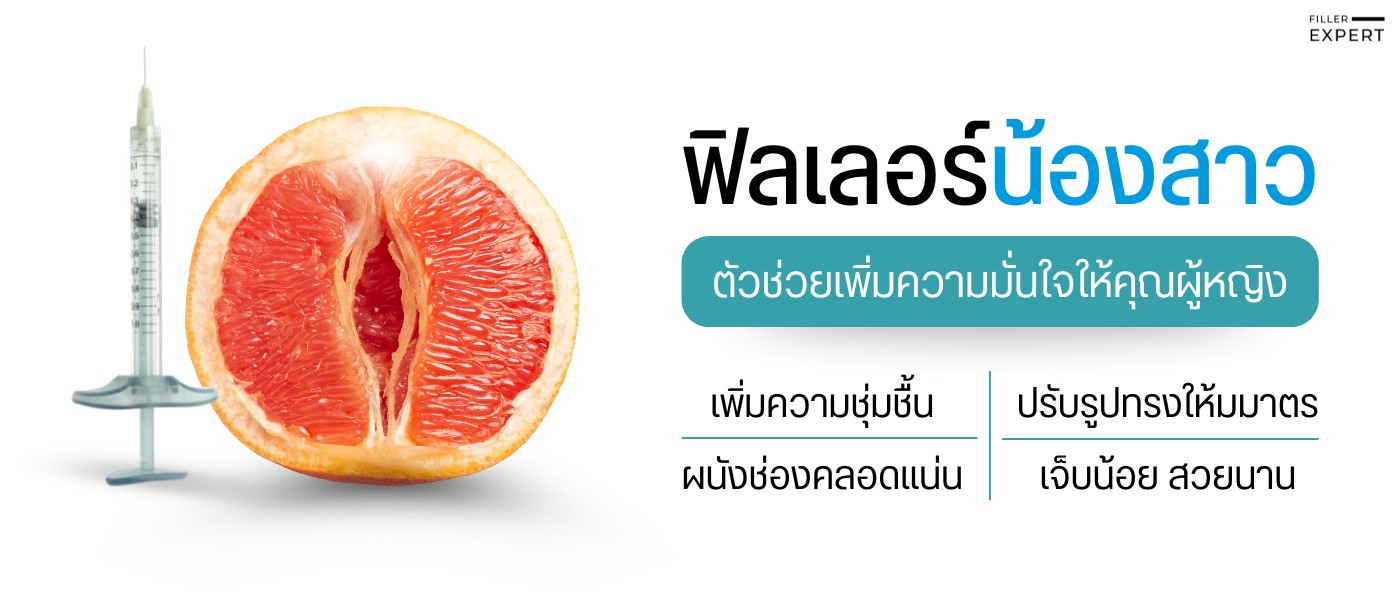ฟิลเลอร์น้องสาว คืออะไร?