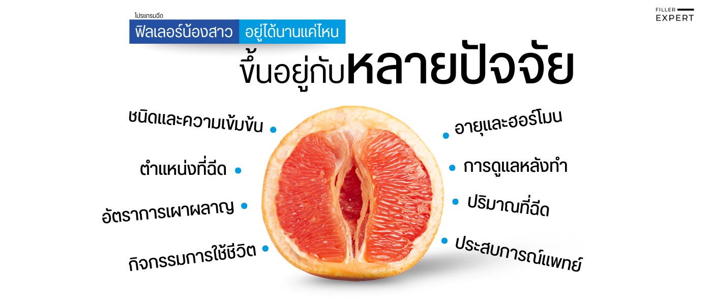 ปัจจัยที่มีผลต่อความคงอยู่ของฟิลเลอร์