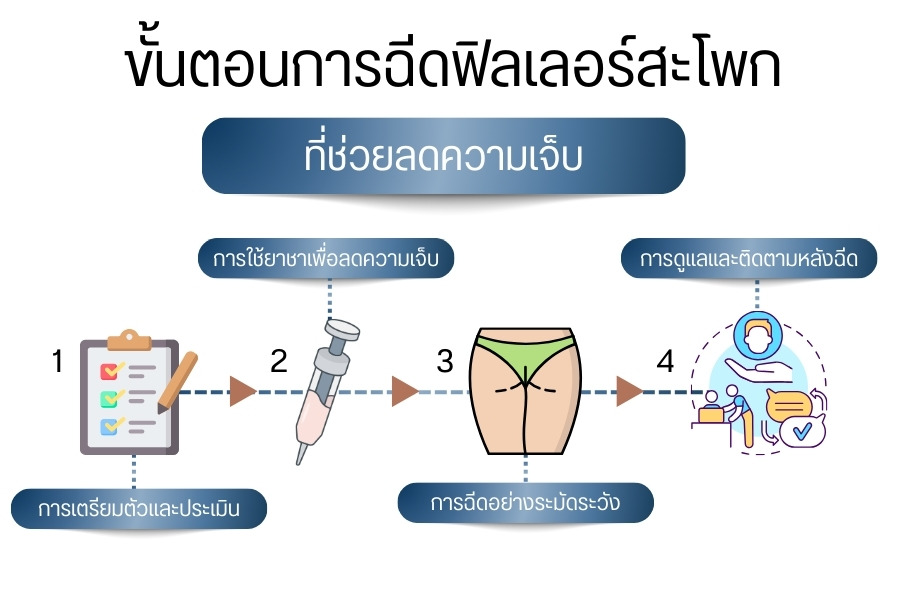 ขั้นตอนการฉีดฟิลเลอร์สะโพกที่ช่วยลดความเจ็บ
