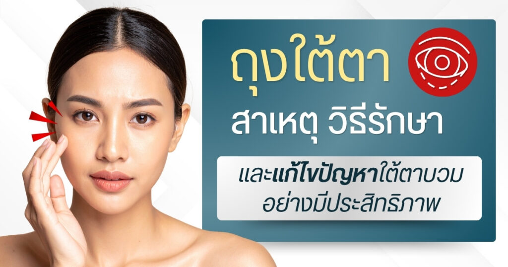 ถุงใต้ตา สาเหตุ วิธีรักษา และแก้ไขปัญหาใต้ตาบวมอย่างมีประสิทธิภาพ