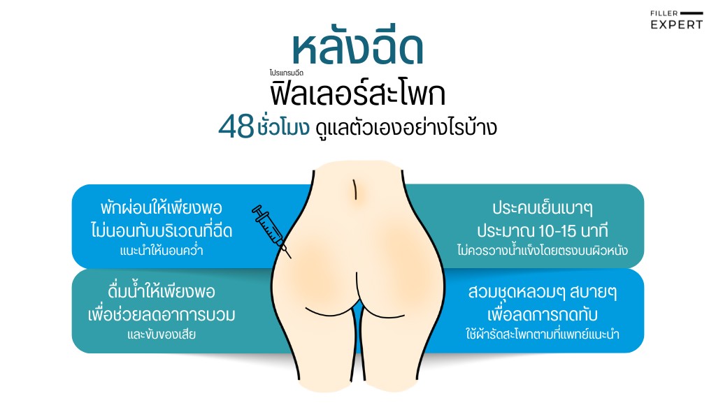 สิ่งที่ควรทำ 48 ชั่วโมงแรก - filler-expert - rwc