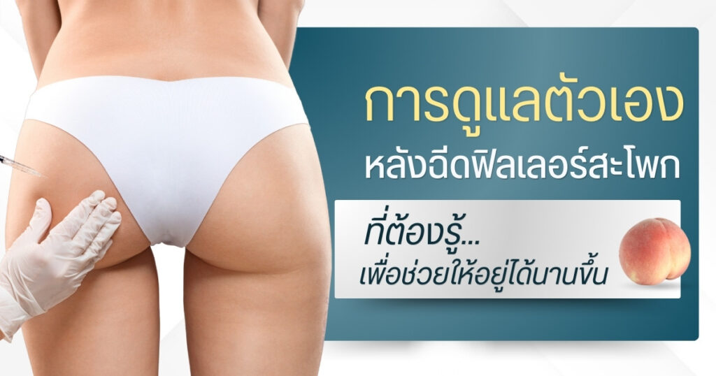 การดูแลตัวเอง หลังฉีดฟิลเลอร์สะโพก ที่ต้องรู้ช่วยให้อยู่นาน