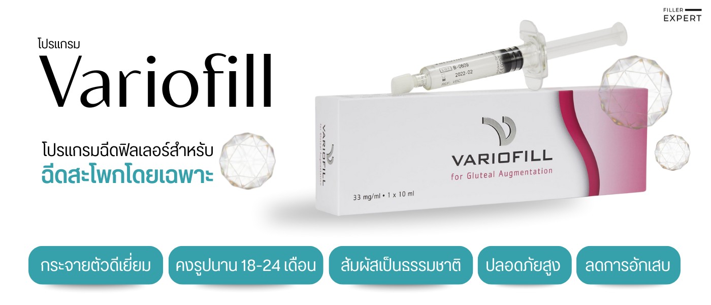 Variofill ฟิลเลอร์สำหรับฉีดสะโพก