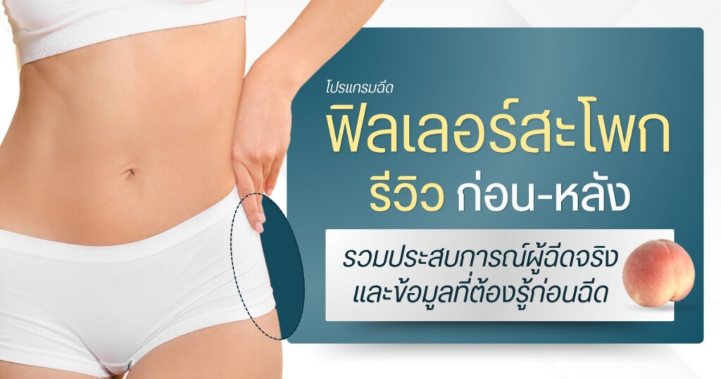 ฟิลเลอร์สะโพก รีวิว รวมประสบการณ์ผู้ฉีดจริงและข้อมูลที่ต้องรู้ก่อนฉีด