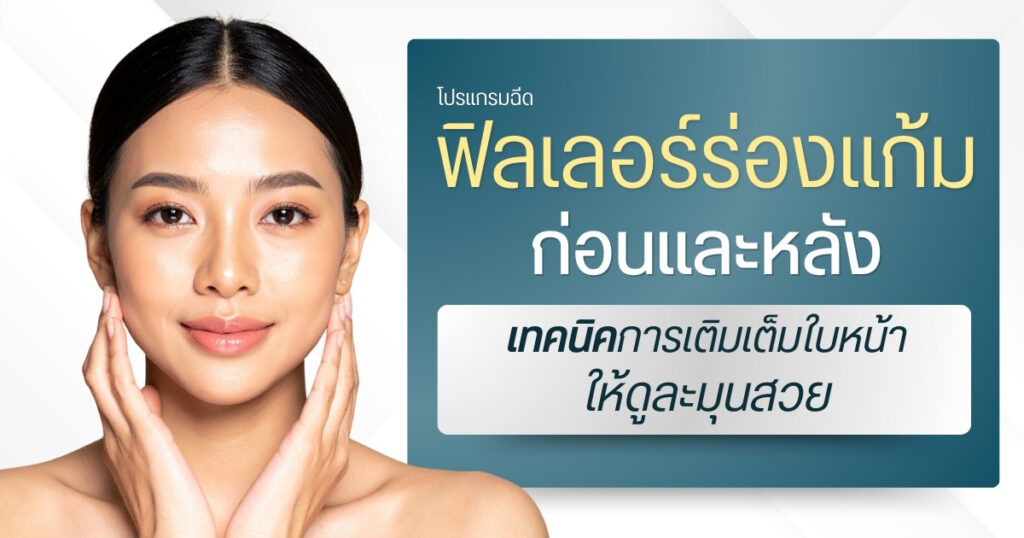 ฟิลเลอร์ร่องแก้มก่อนและหลัง : เทคนิคการเติมเต็มใบหน้าให้ดูละมุนสวย