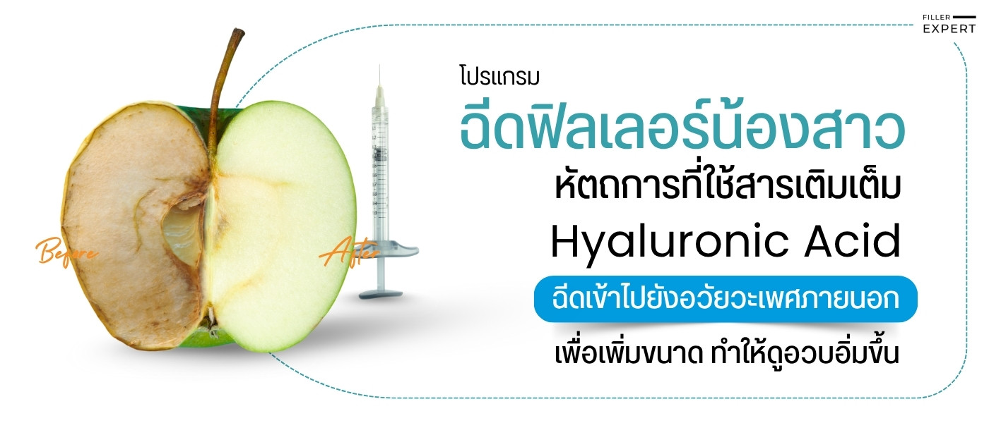 การฉีดฟิลเลอร์น้องสาวคืออะไร และเหมาะกับใคร