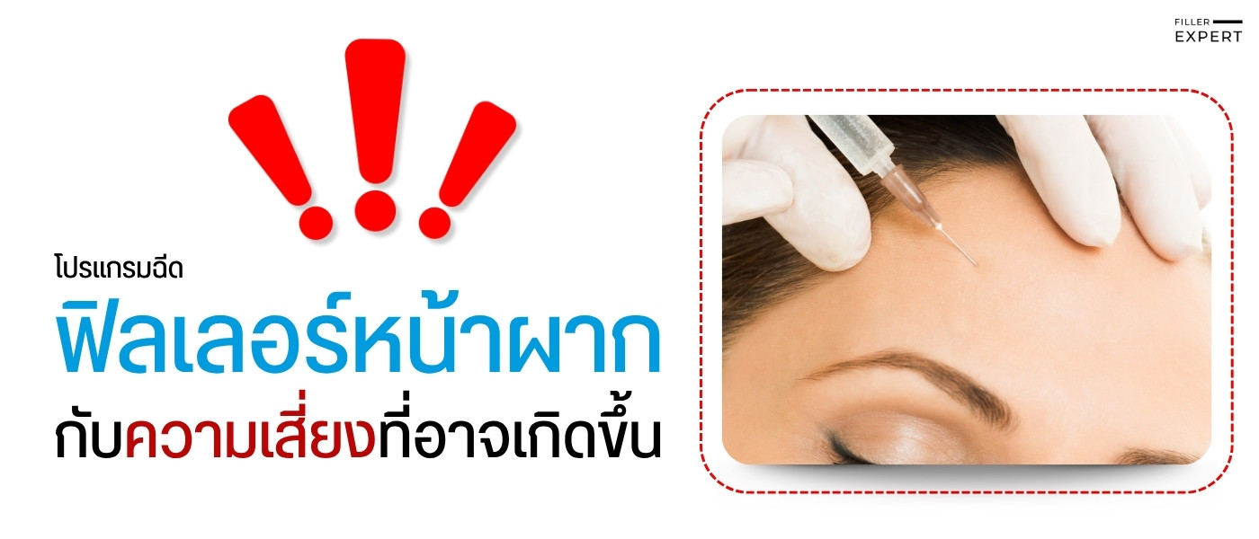 ฟิลเลอร์หน้าผาก อันตรายไหม?