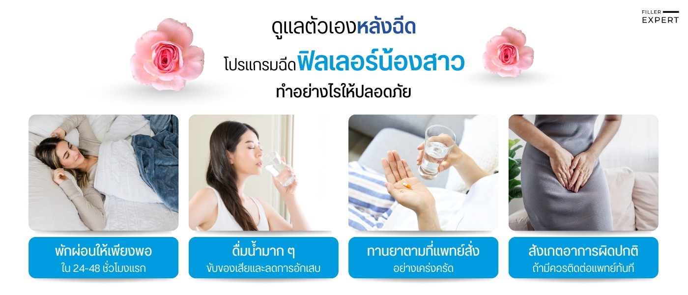 การดูแลหลังฉีดฟิลเลอร์น้องสาวอย่างไรให้ปลอดภัย