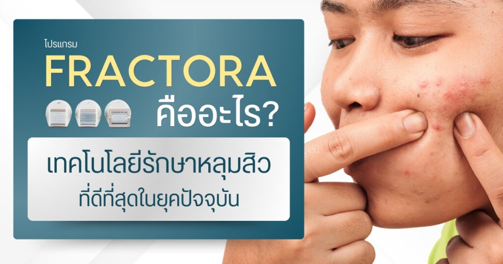 Fractora คืออะไร? เทคโนโลยีรักษาหลุมสิวที่ดีที่สุดในยุคปัจจุบัน