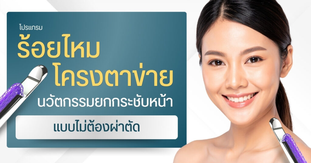 ร้อยไหมโครงตาข่าย นวัตกรรมยกกระชับใบหน้าแบบไม่ต้องผ่าตัด