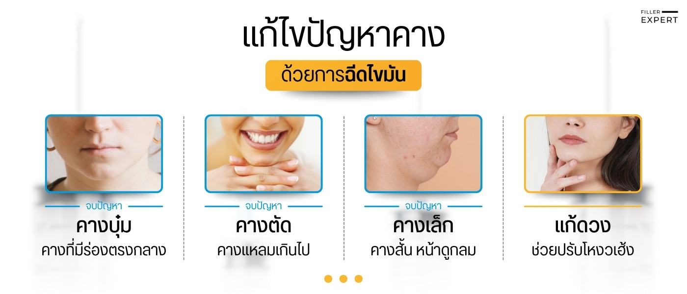 ฉีดไขมันคางคืออะไร และช่วยแก้ปัญหาอะไรได้บ้าง