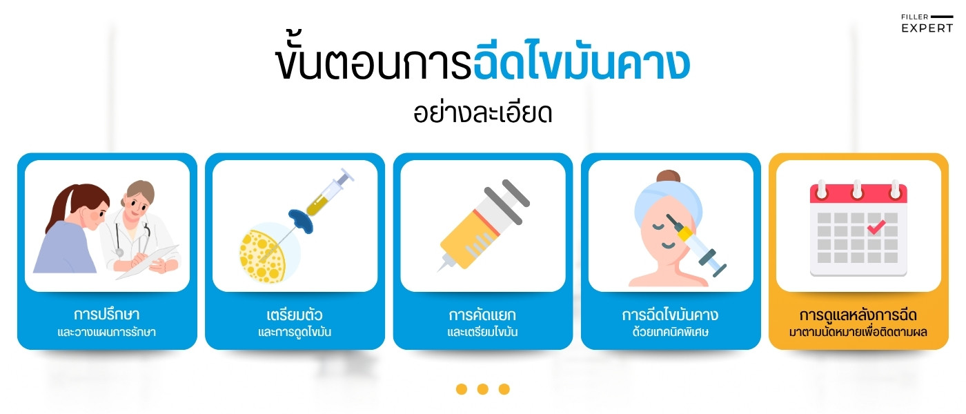ขั้นตอนการฉีดไขมันคางอย่างละเอียด