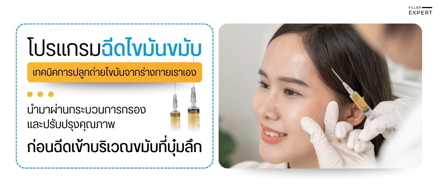 ฉีดไขมันขมับคืออะไร