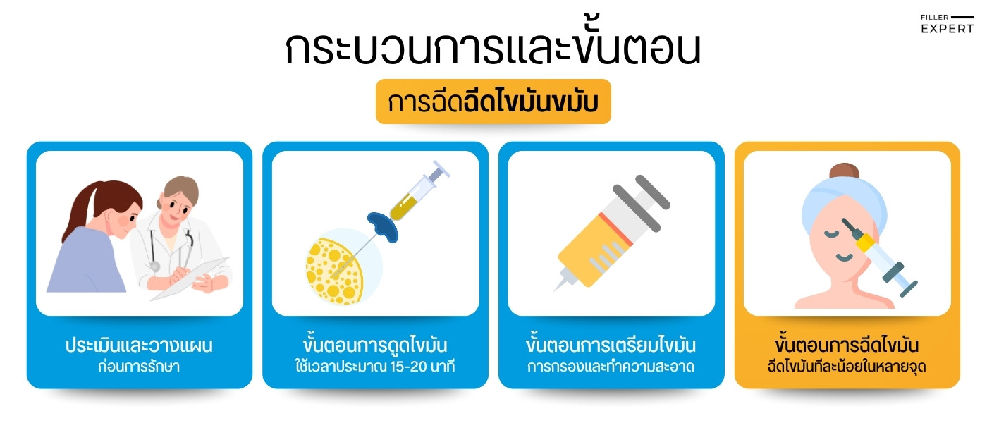 ขั้นตอนและเทคนิคการฉีดไขมันขมับ