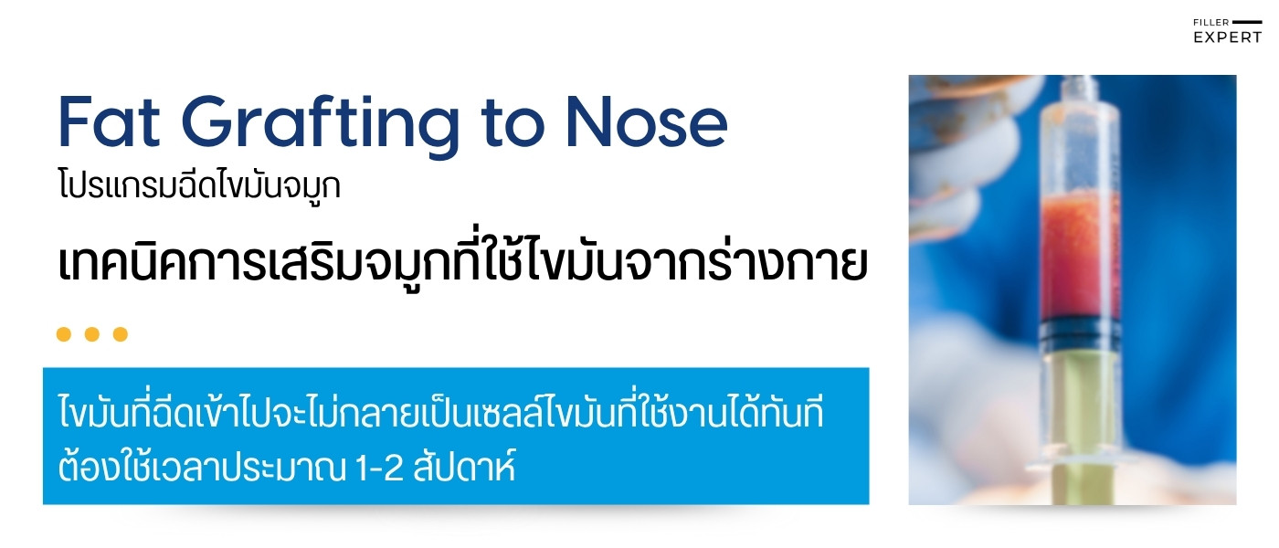 การฉีดไขมันจมูกคืออะไร และทำงานอย่างไร