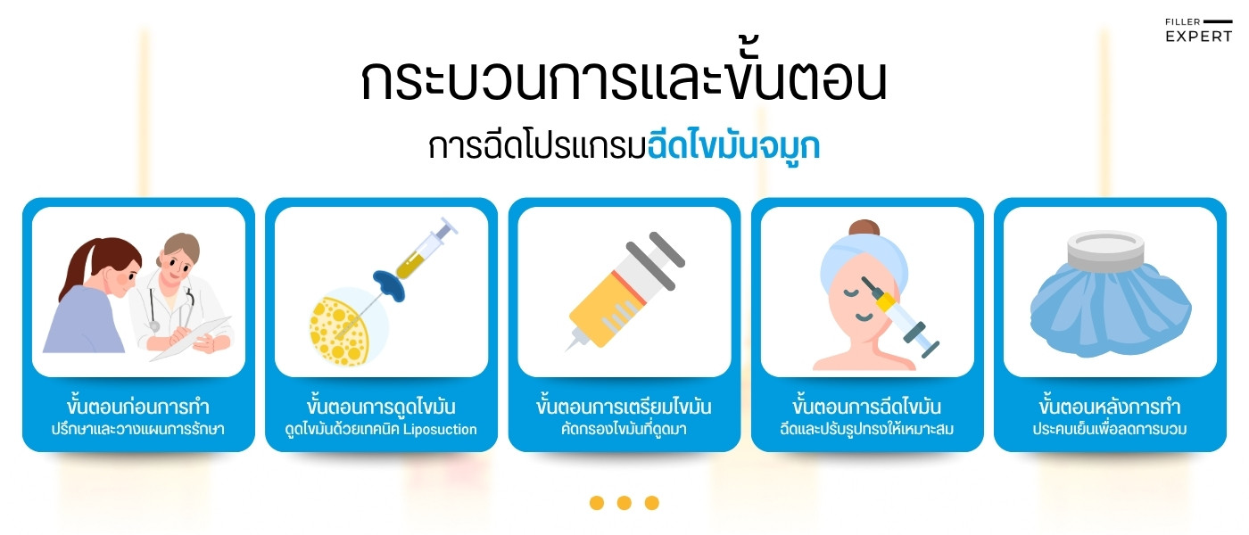 กระบวนการและขั้นตอนการฉีดไขมันจมูก