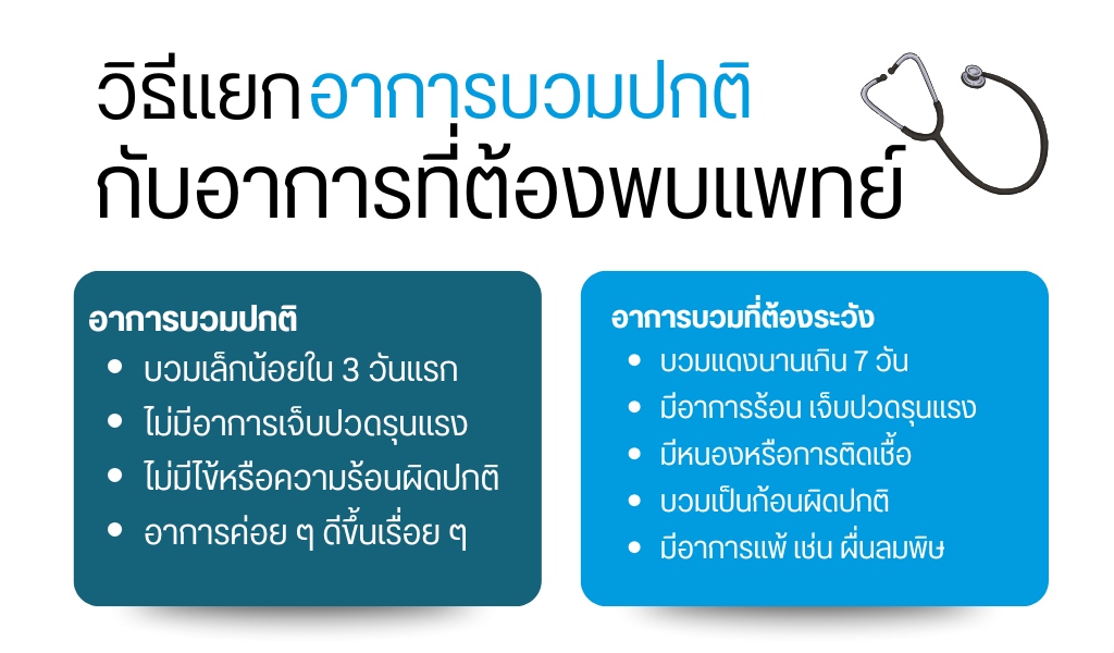 วิธีแยกอาการบวมปกติกับอาการที่ต้องพบแพทย์
