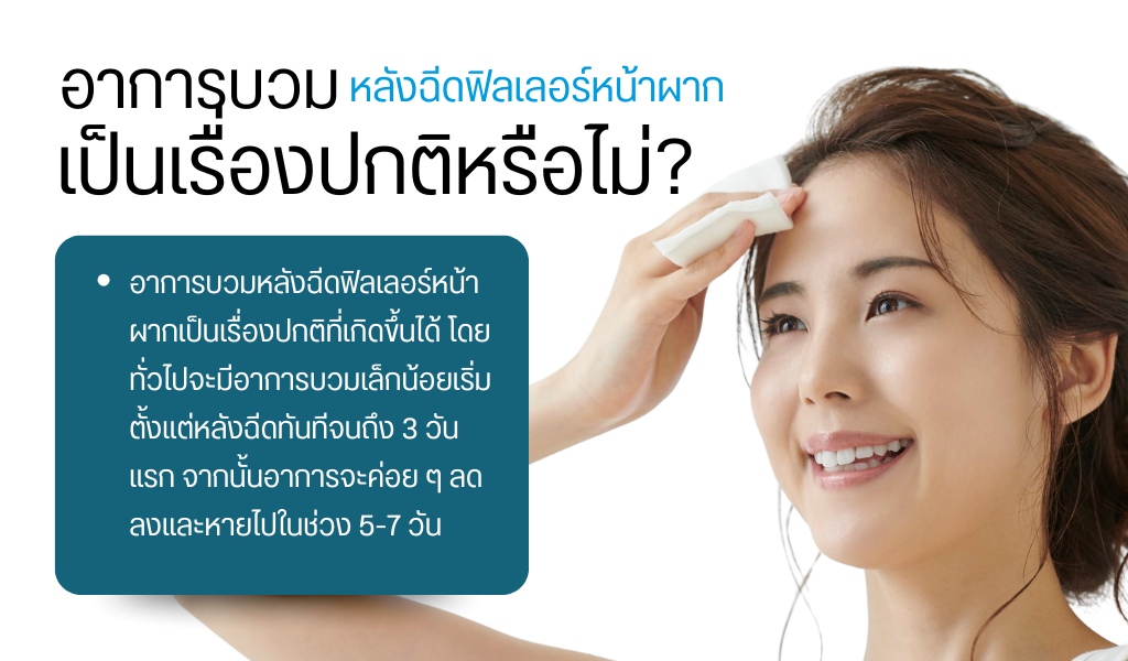 อาการบวมหลังฉีดฟิลเลอร์หน้าผาก เป็นเรื่องปกติหรือไม่?