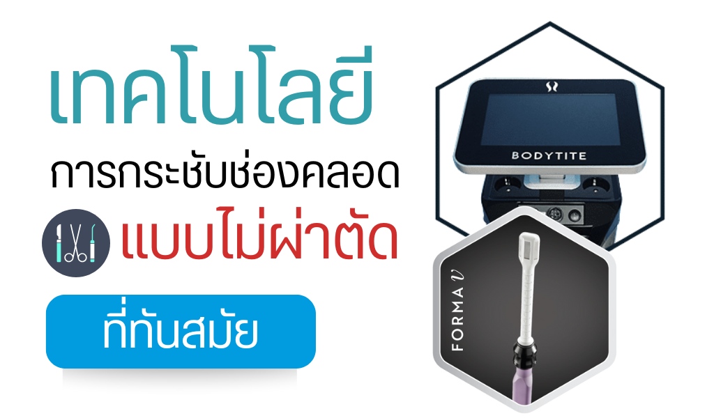 เทคโนโลยีการกระชับช่องคลอดแบบไม่ผ่าตัดที่ทันสมัย