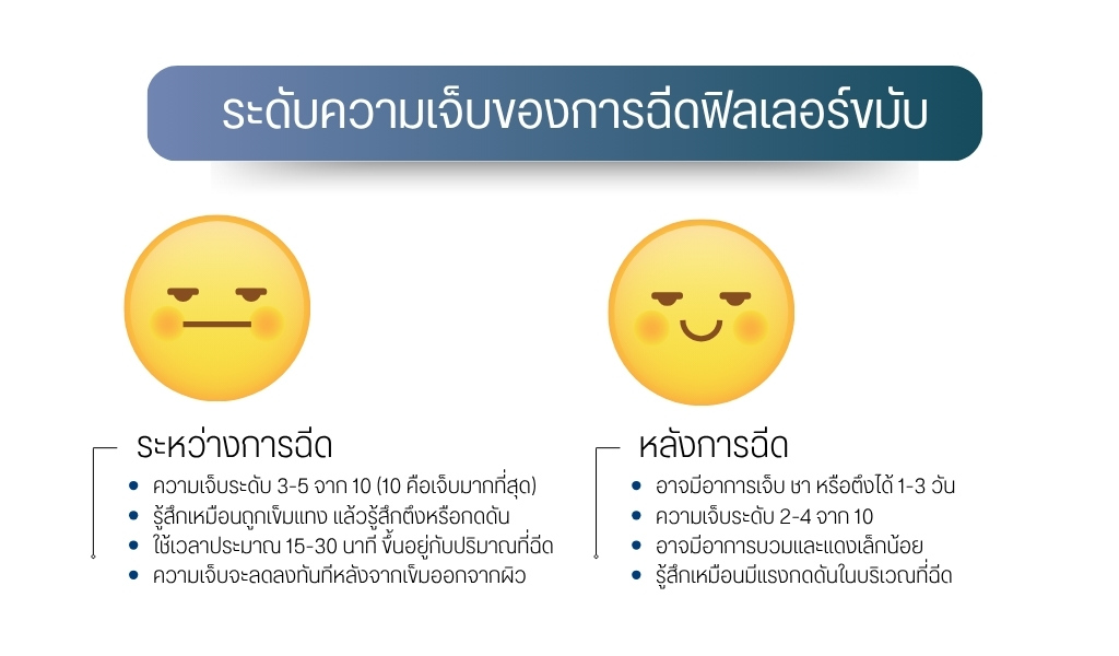 ระดับความเจ็บของการฉีดฟิลเลอร์ขมับ