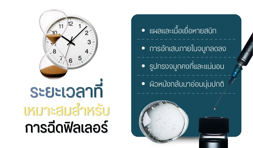 ระยะเวลาที่เหมาะสมสำหรับการฉีดฟิลเลอร์