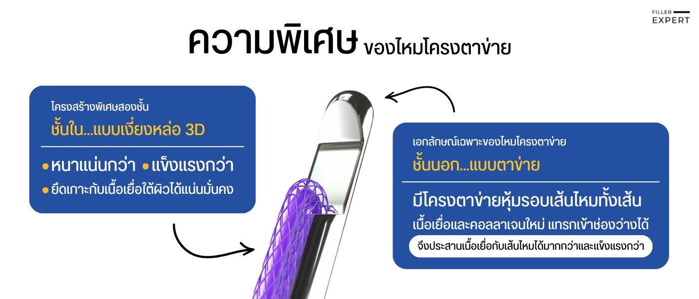 ร้อยไหมโครงตาข่าย (Tesslift) คืออะไร