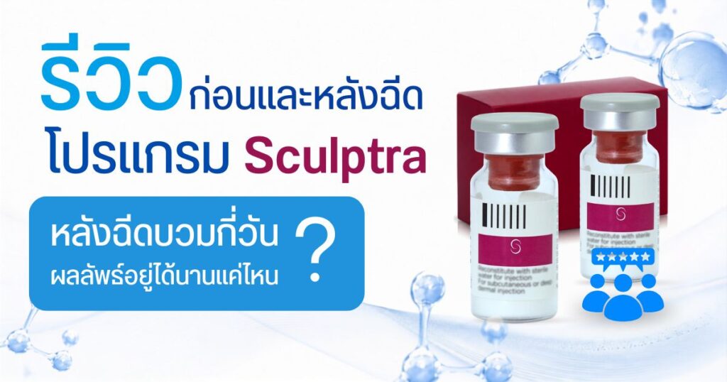 Sculptra รีวิว ก่อน-หลังฉีด บวมกี่วัน อยู่ได้นานแค่ไหน