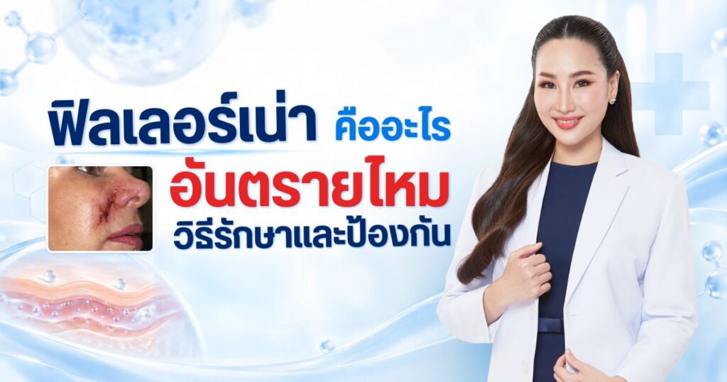 หยุด !! ฟิลเลอร์เน่า คืออะไร อันตรายไหม วิธีรักษาและป้องกัน